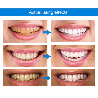 🔥 Promotion 49% OFF🔥-Teeth Whitening Essence